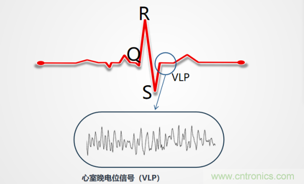 解決心電監(jiān)測(cè)行業(yè)難題，曼森伯格的濾波技術(shù)獲國(guó)家知識(shí)產(chǎn)權(quán)局發(fā)明授權(quán)