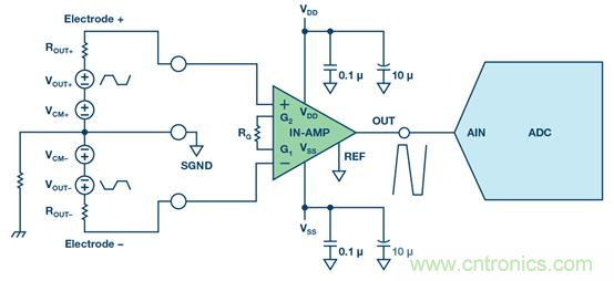 如何設(shè)計典型的模擬前端電路