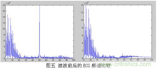 采用MSP430設計的12位心電(ECG)放大器